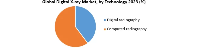Digital X-ray Market2
