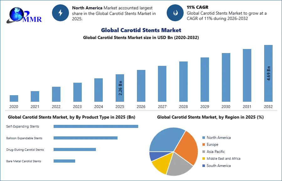 Global Carotid Stents Market