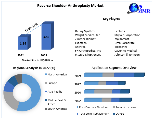 Reverse Shoulder Anthroplasty Market