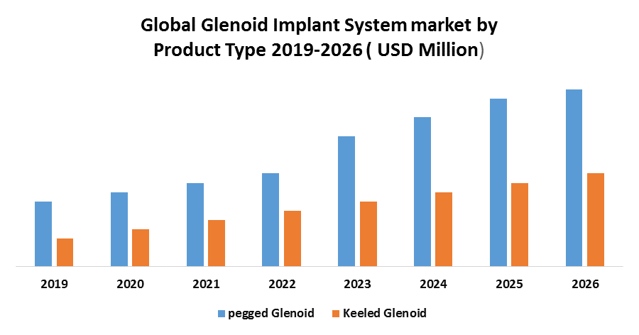 Global Glenoid Implant System Market: Industry Analysis