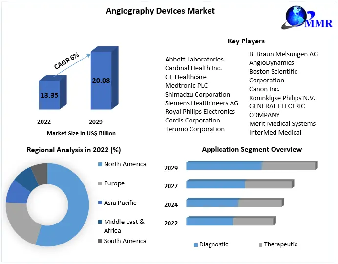Angiography equipment market