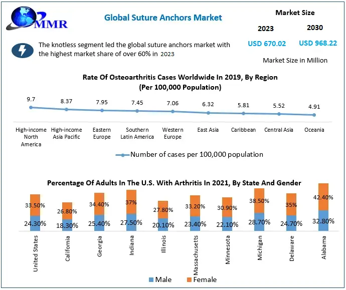 Suture Anchors Market (1)