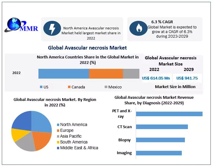 Avascular Necrosis Market: Increase in the prevalence of Avascular